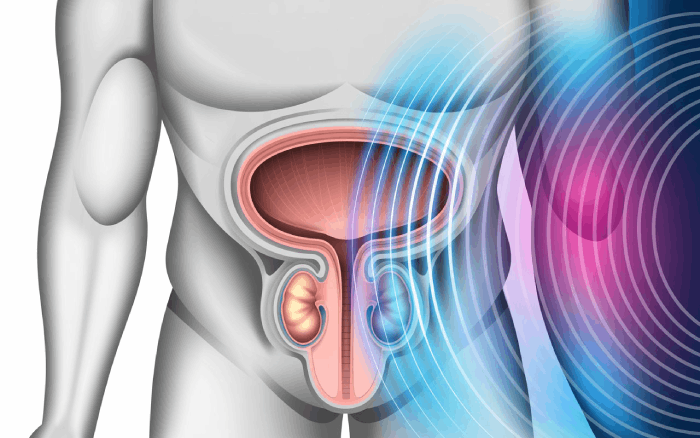 Prostate Problems Erectile Disfunction